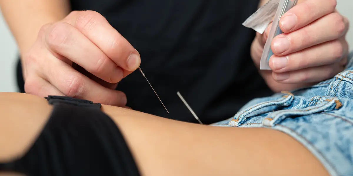 Akupunktur i Bogense,